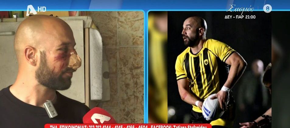 Αθλητής ΑΕΚ που έπεσε θύμα ξυλοδαρμού έξω από το σπίτι του: «Κατάλαβα ότι πρόκειται για οπαδούς του Ολυμπιακού»