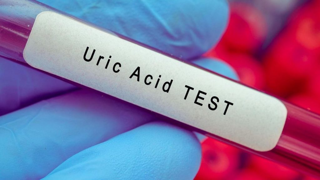 Τα αυξημένα επίπεδα ουρικού οξέος στο αίμα γερνάνε πρόωρα τον εγκέφαλο και προκαλούν αλλοιώσεις