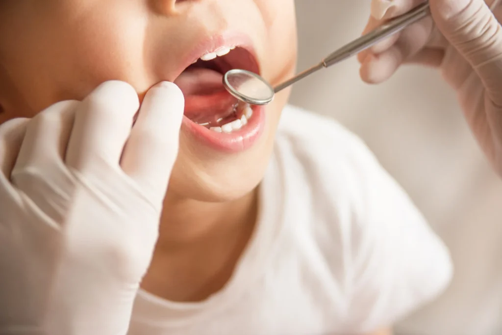 Dentist pass: «Πρεμιέρα» σήμερα για τι αιτήσεις από κηδεμόνες παιδιών που το ΑΦΜ τους λήγει σε 3
