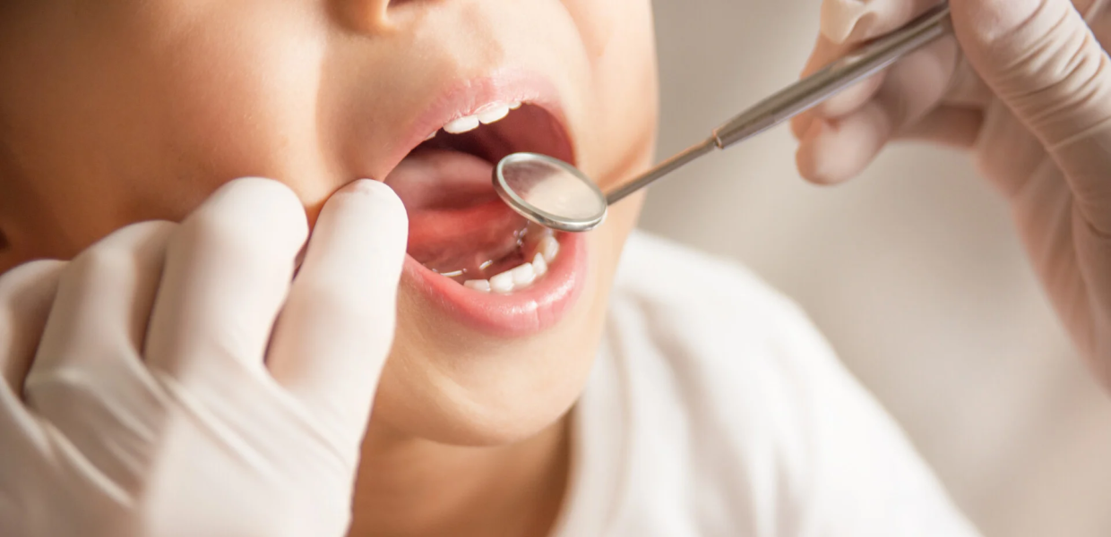 Dentist Pass: Ποια ΑΦΜ μπορούν να υποβάλλουν αίτηση σήμερα