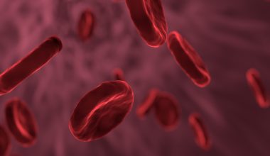 Νέα μελέτη για τον καρκίνο του αίματος: Επαναστατική θεραπεία μειώνει την εξέλιξη της νόσου κατά 74%