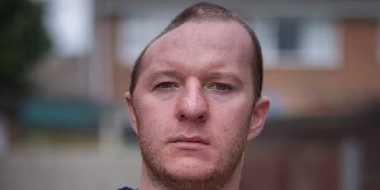 Βρετανία: Έχασε το μισό του κρανίο μετά από ένα χτύπημα και ο δράστης βγαίνει από τη φυλακή μετά από 4 μήνες!