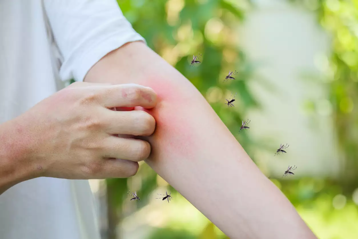 Πέντε κόλπα για να μην σας τσιμπάνε τα κουνούπια