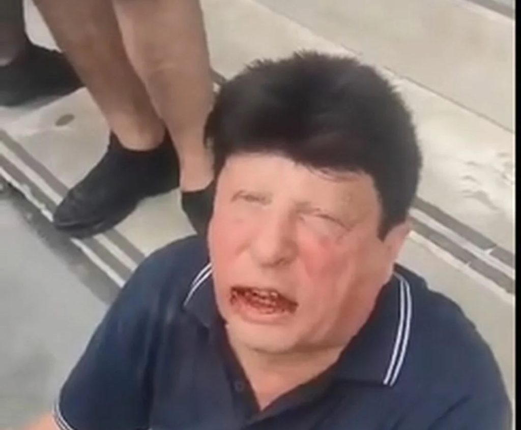 «Ήταν συνέχεια έξω απ’ τον παιδότοπο ο παιδόφιλος που συνελήφθη στην Ομόνοια» λέει ο πατέρας της 14χρονης