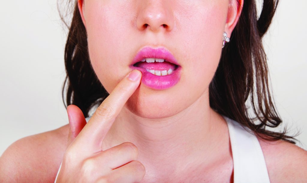 Στοματικός έρπης: Συμπτώματα, αιτίες και διάγνωση – Οι επιλογές θεραπείας