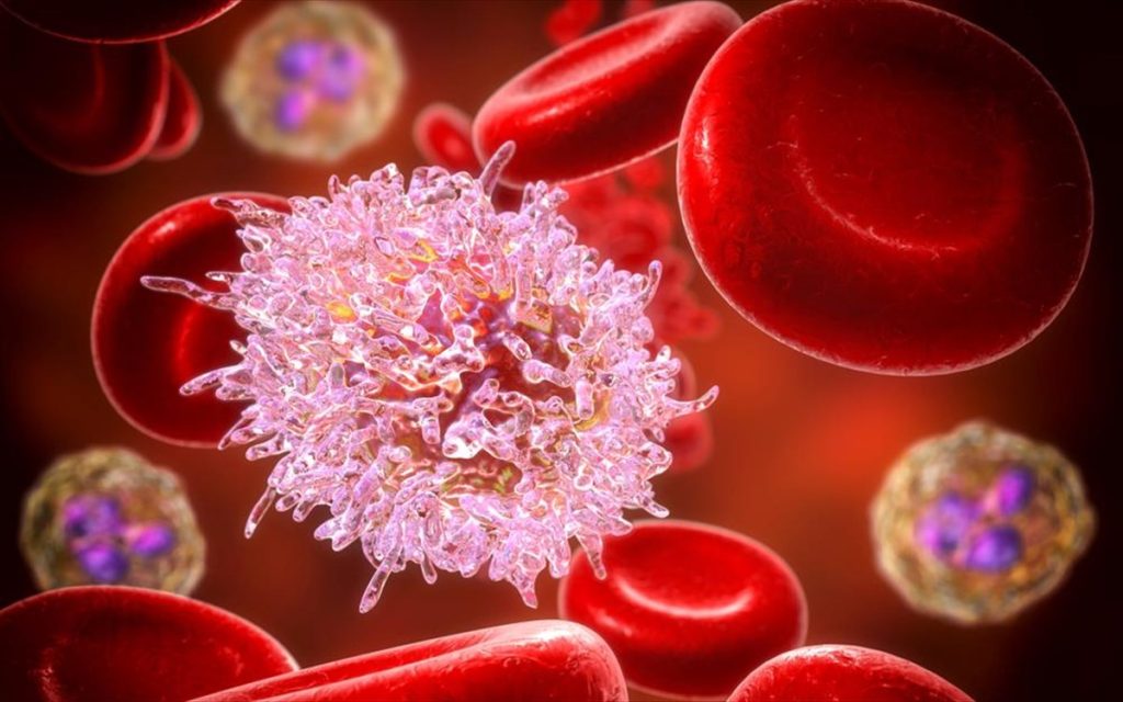 Λευχαιμία: Δείτε ποια είναι τα οκτώ συμπτώματα που δεν πρέπει να αγνοήσετε