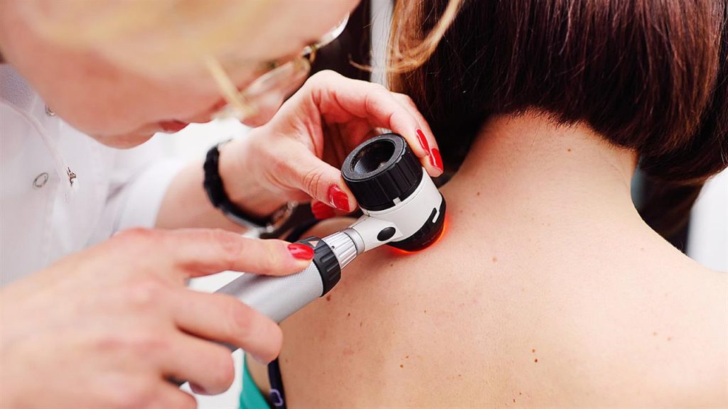 Όλα όσα πρέπει να ξέρετε για το αμελανωτικό μελάνωμα – Πότε ο καρκίνος του δέρματος έχει το ίδιο χρώμα με το δέρμα