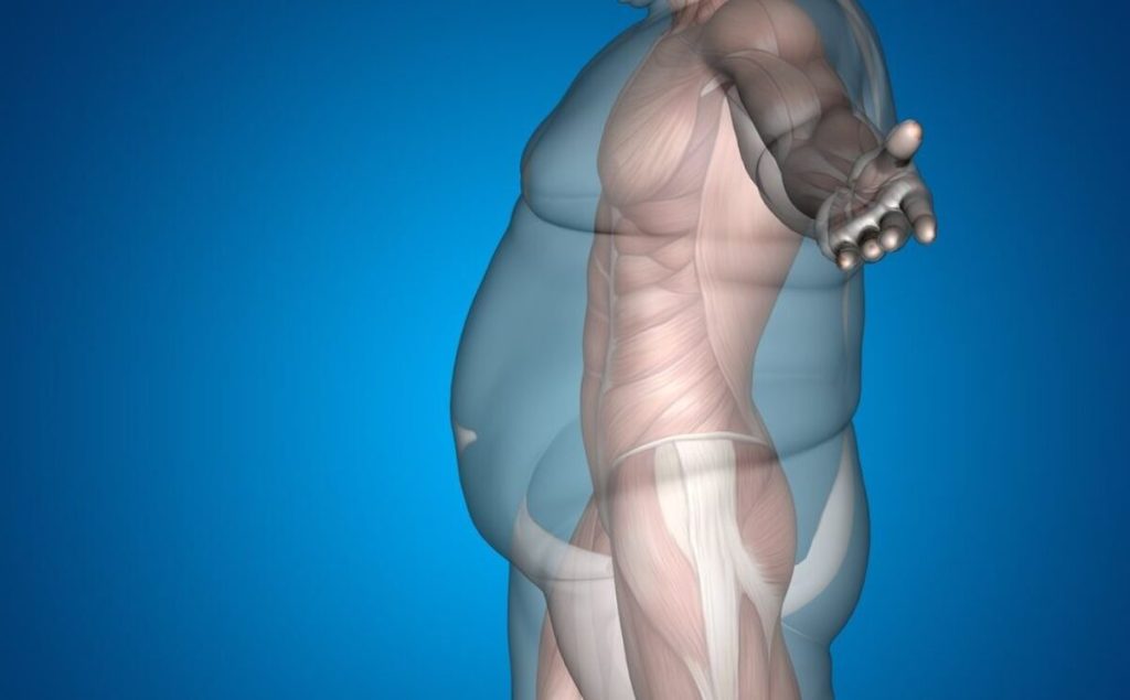 Μελέτη: Οι επιπτώσεις που έχει στα οστά η επέμβαση απώλειας βάρους