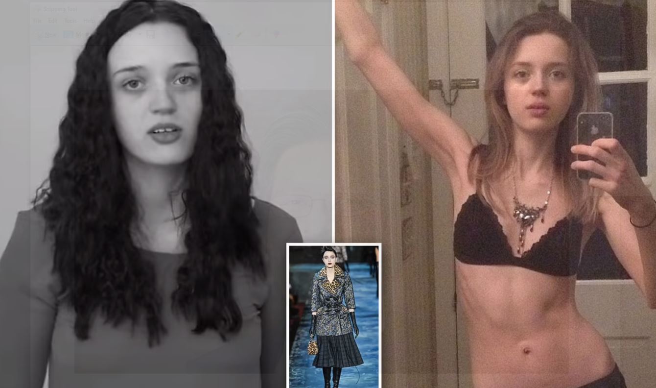 Αδιανόητες τεχνικές αδυνατίσματος από πρακτορείο μοντέλων: Πρότειναν σε κοπέλα να καταπιεί μπάλες βαμβακιού (φωτό)