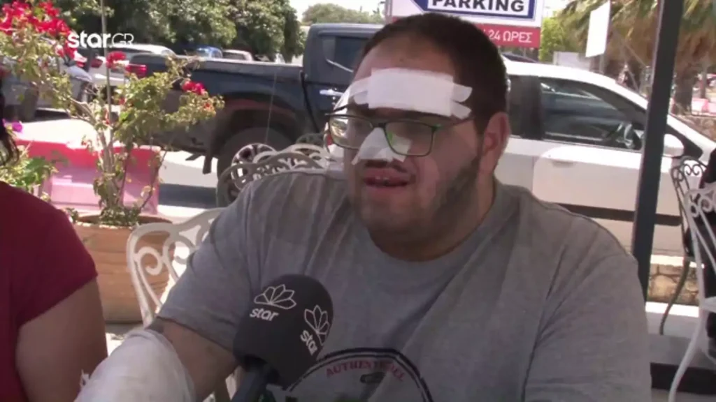 Κρήτη: «Με έβαλαν σε δωμάτιο με ωμά κρέατα» – Απίστευτη καταγγελία μάγειρα που έπαθε εγκαύματα από καυτό λάδι