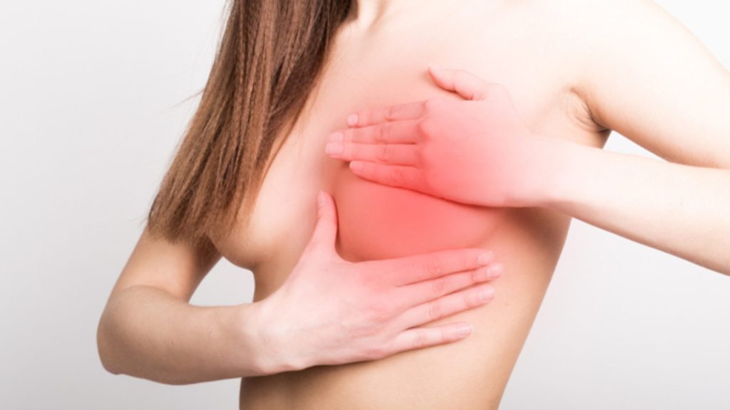Νέα έρευνα: Οι γυναίκες με «ακίνδυνα» εξογκώματα στο στήθος έχουν σχεδόν διπλάσιες πιθανότητες για καρκίνο