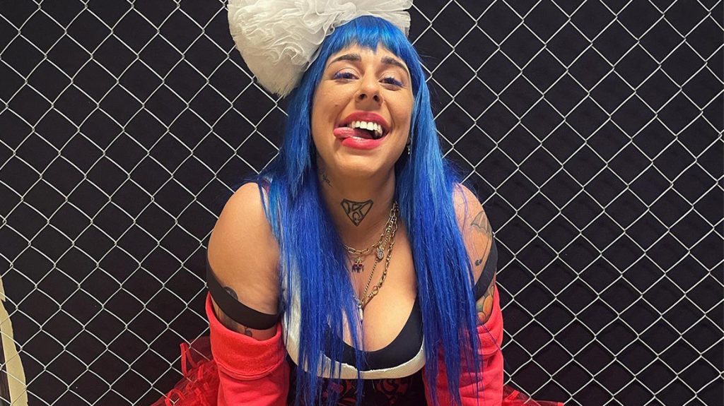 Super Κική: Η πρώτη φωτογραφία μετά το χειρουργείο αφαίρεσης λίπους