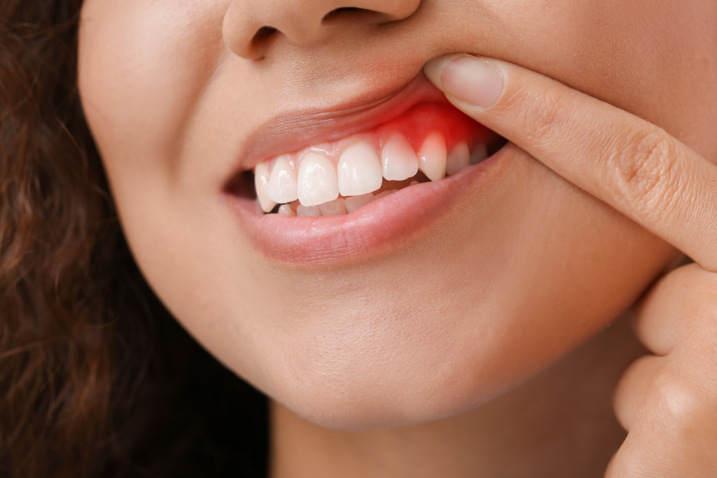 Μελέτη: Η περιοδοντίτιδα και η απώλεια δοντιών συνδέονται με τη συρρίκνωση του εγκεφάλου στον ιππόκαμπο