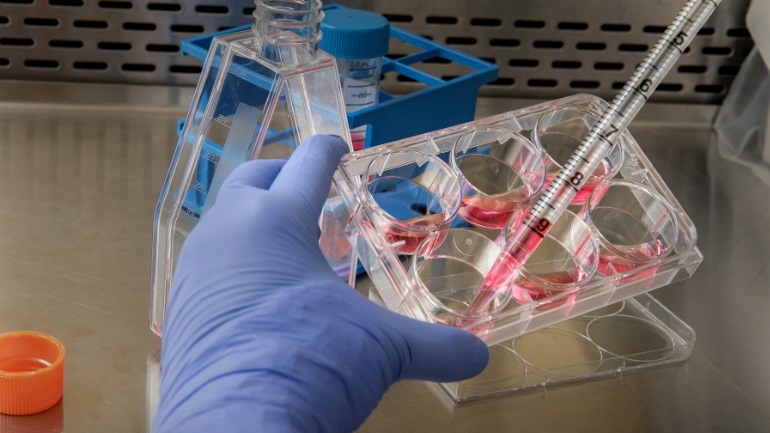 Το Περού κήρυξε κατάσταση υγειονομικής έκτακτης ανάγκης λόγω έξαρσης του συνδρόμου Γκιγιέν-Μπαρέ