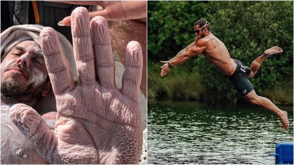 Άνδρας προσπάθησε να σπάσει παγκόσμιο ρεκόρ και έπαθε θερμοπληξία – Πώς έγινε το σώμα του μετά από 27 ώρες στο νερό