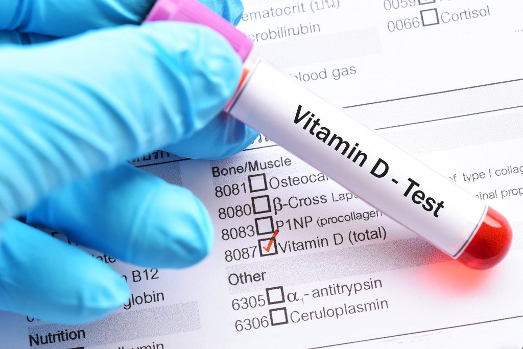 Ποια είναι η ιδανική ώρα για πάρετε το συμπλήρωμα βιταμίνης D; – Το πρωί ή το βράδυ;