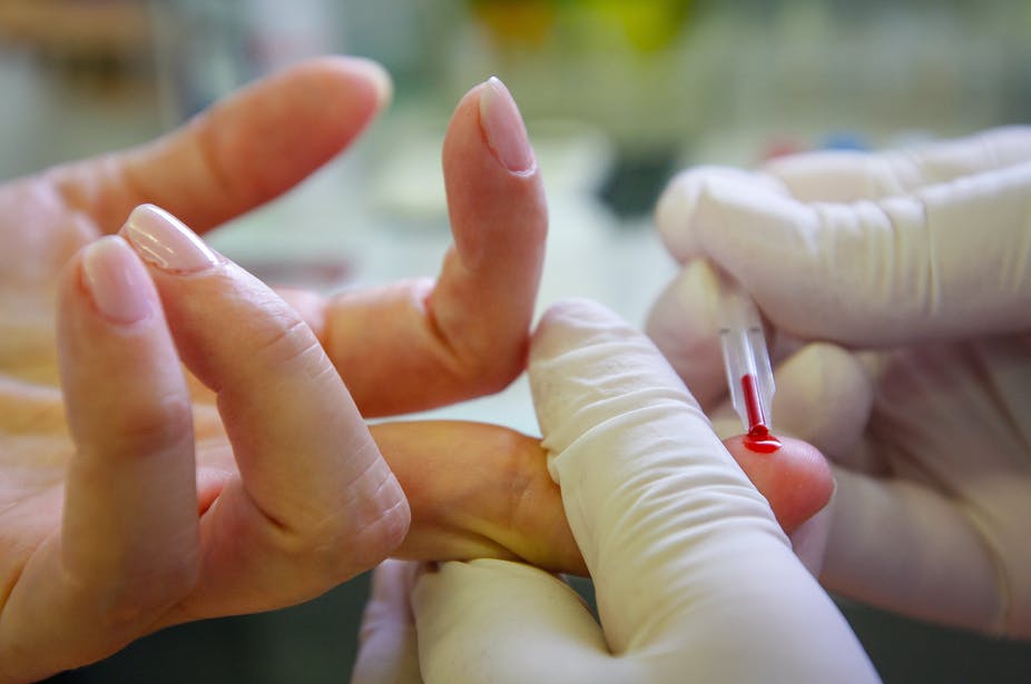 Αλτσχάιμερ: Ελπίδες για την έγκαιρη ανίχνευση με τεστ αίματος από ένα απλό τσίμπημα στο δάχτυλο