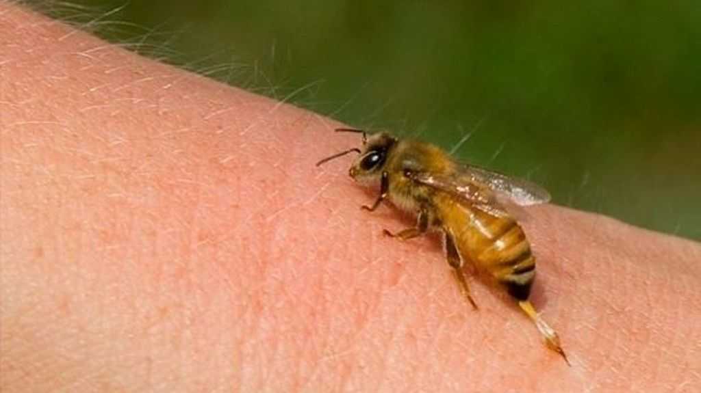 Τσίμπημα από μέλισσα, σφήκα ή άλλα έντομα: Πώς να τα αντιμετωπίσετε