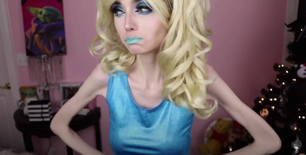 YouTuber με νευρική ανορεξία προκάλεσε πανικό με νέο βίντεο της – «Θα πεθάνει αν δεν λάβει βοήθεια σύντομα»