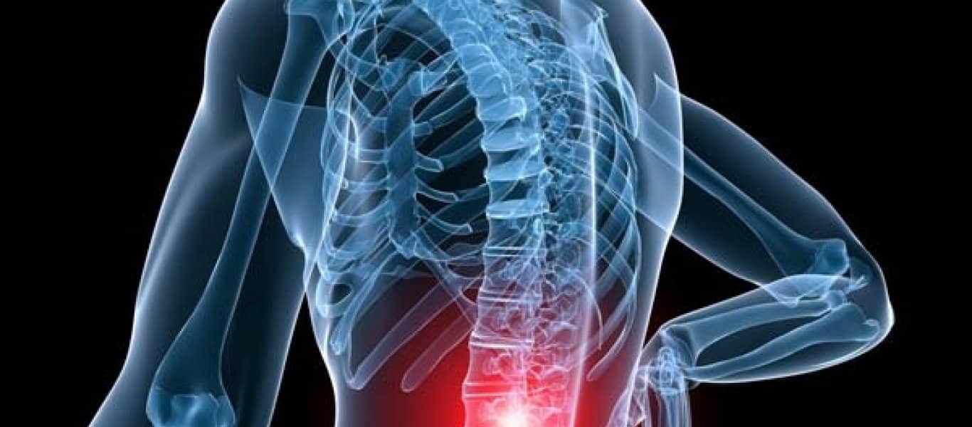 Οσφυαλγία και πονοκέφαλος: Δύο διαταραχές με άρρηκτη σχέση