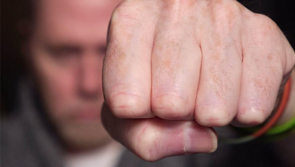 Λάρισα: Σε σοβαρή κατάσταση η γυναίκα που ξυλοκοπήθηκε από τον σύζυγό της – Παραπομπή του για απόπειρα ανθρωποκτονίας