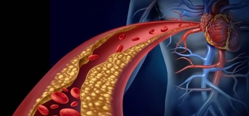 Καρδιακή νόσος: Αυτά είναι τα πρώτα συμπτώματα