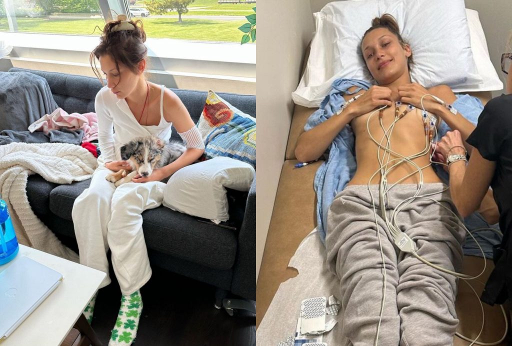 Μπέλα Χαντίντ: Σοκάρουν οι φωτογραφίες από την περίοδο της θεραπείας της – Κουρασμένη και με σωληνάκια