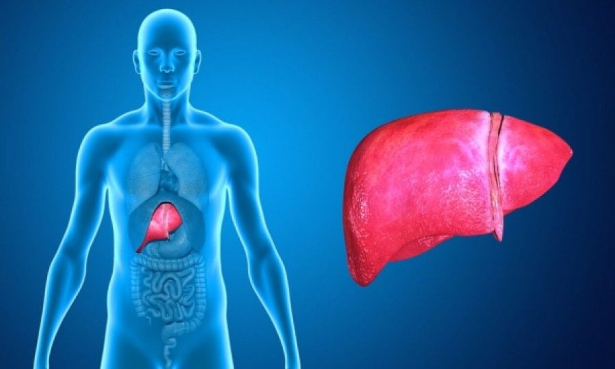 Κίρρωση ήπατος: Πόσο αυξάνει τον κίνδυνο ηπατοκυτταρικού καρκίνου