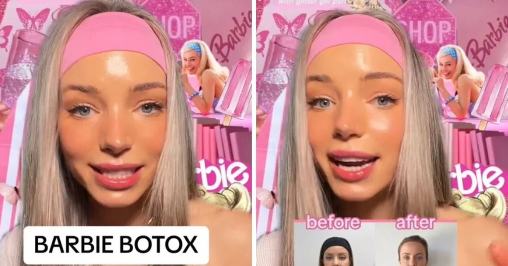 Τι είναι το «Barbie Botox» που έχει «τρελάνει» το διαδίκτυο – Ποιους κίνδυνους επιφυλάσσει