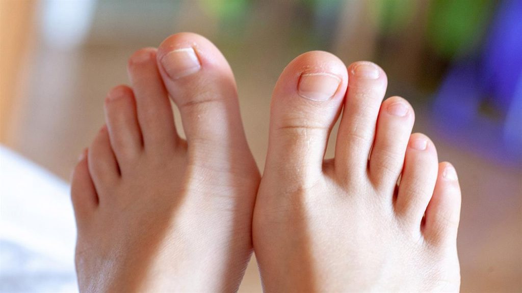 Αυτά είναι τα συμπτώματα και τα σημάδια της ονυχομυκητίασης