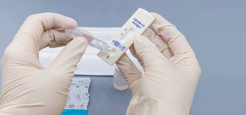 Επιτροπή Ανταγωνισμού: Πρόστιμα 373.943 ευρώ σε τρεις εταιρείες για τα rapid test