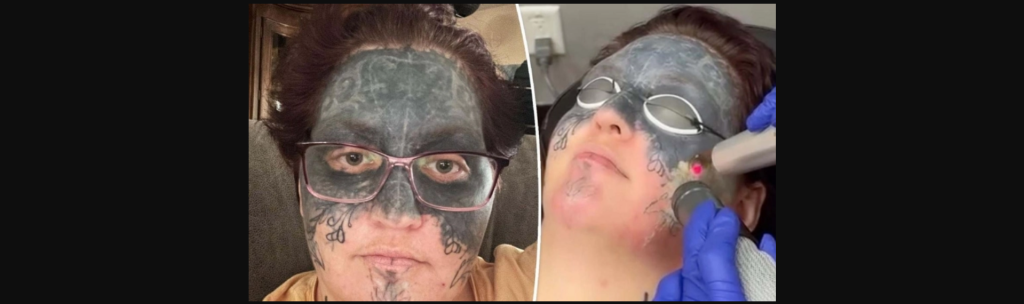 ΗΠΑ: Τη νάρκωσαν και της έκαναν τατουάζ σε όλο της το πρόσωπο – Μετά από 10 χρόνια ο εφιάλτης τελειώνει (βίντεο)