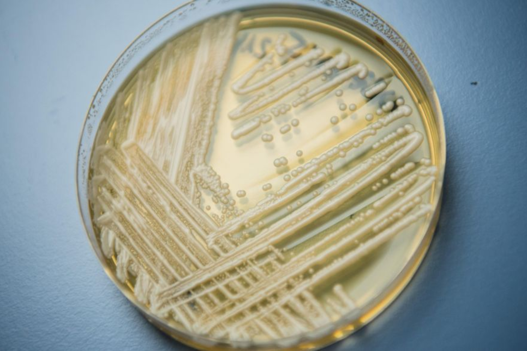 Candida auris: Εντοπίστηκε κρούσμα στην Κρήτη – Γυναίκα βρίσκεται στην απομόνωση στο Νοσοκομείο Χανίων