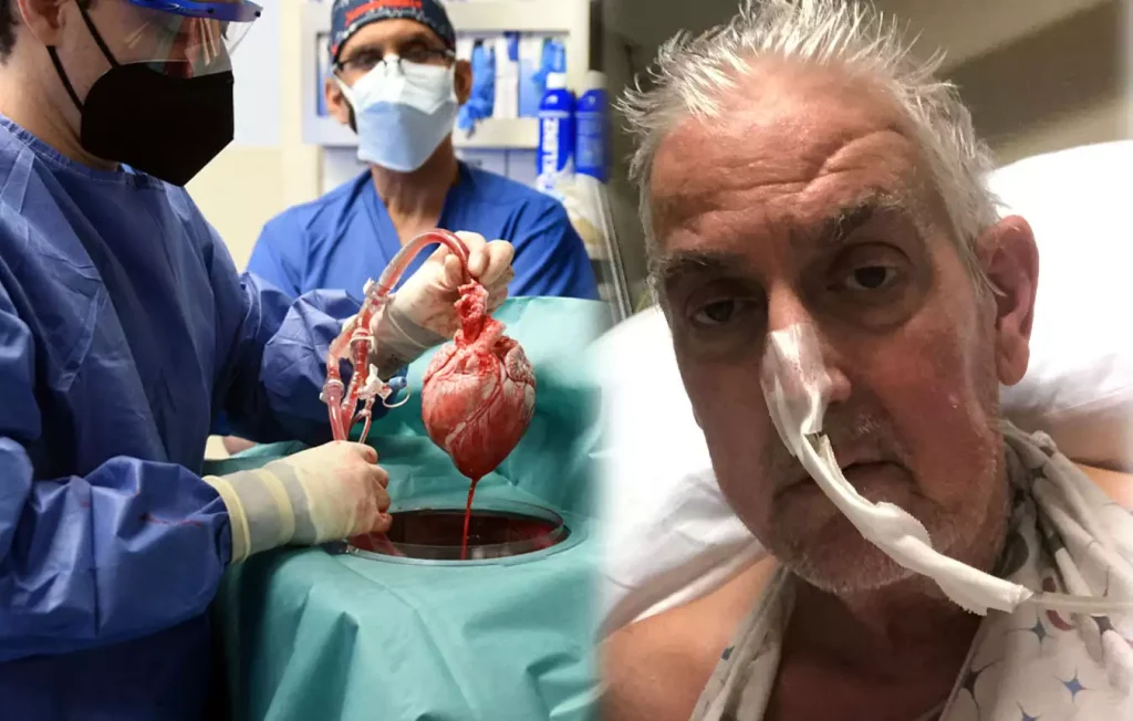 Μεταμόσχευση καρδιάς από χοίρο σε άνθρωπο: Πραγματοποιήθηκε ξανά με επιτυχία