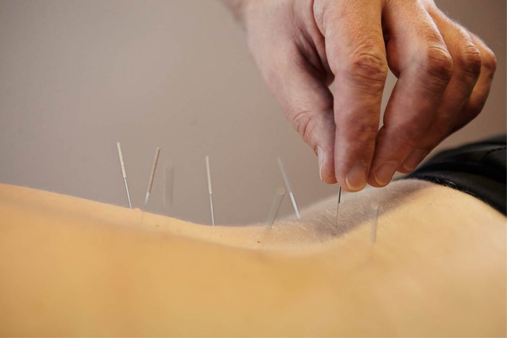 ΗΠΑ: Ηλικιωμένος βελονιστής προκάλεσε μερική παράλυση σε ασθενή και της επιτέθηκε σεξουαλικά