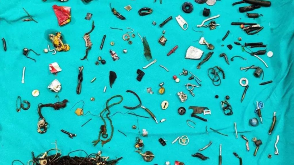 Έγινε και αυτό στην Ινδία: Άνδρας πήγε με στομαχόπονο στο νοσοκομείο και οι γιατροί έβγαλαν από το έντερό του 60 αντικείμενα