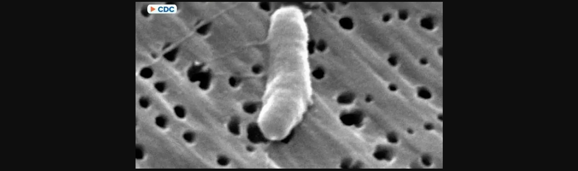 Ατλάντα: Εντοπίστηκε παρασιτικό σκουλήκι που μπορεί να εισέλθει στον εγκέφαλο (βίντεο)