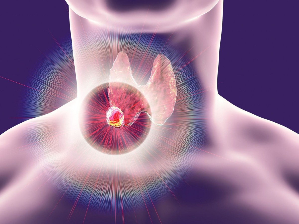 Μελέτη: Δείτε πόσο αυξάνουν τον κίνδυνο για καρκίνο του θυρεοειδούς τα πλαστικά