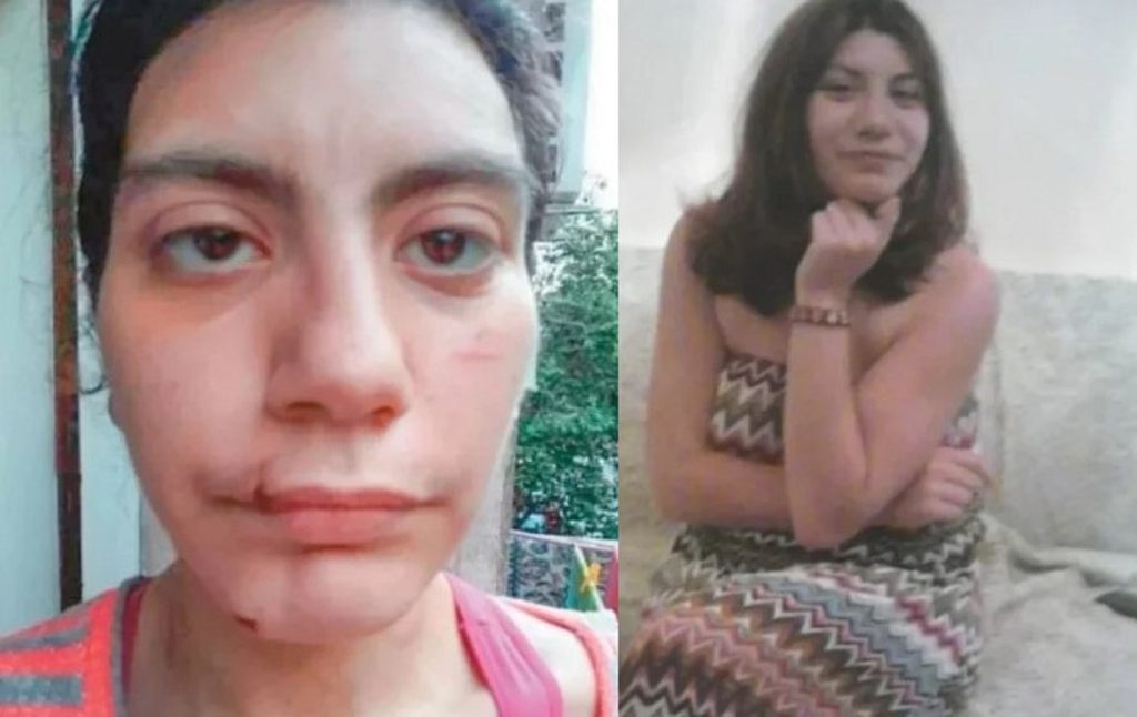 Φ.Μπακογιώργου: «Ήταν μόνιμα χτυπημένη σε όλο της το σώμα» αποκαλύπτει ένοικος της πολυκατοικίας