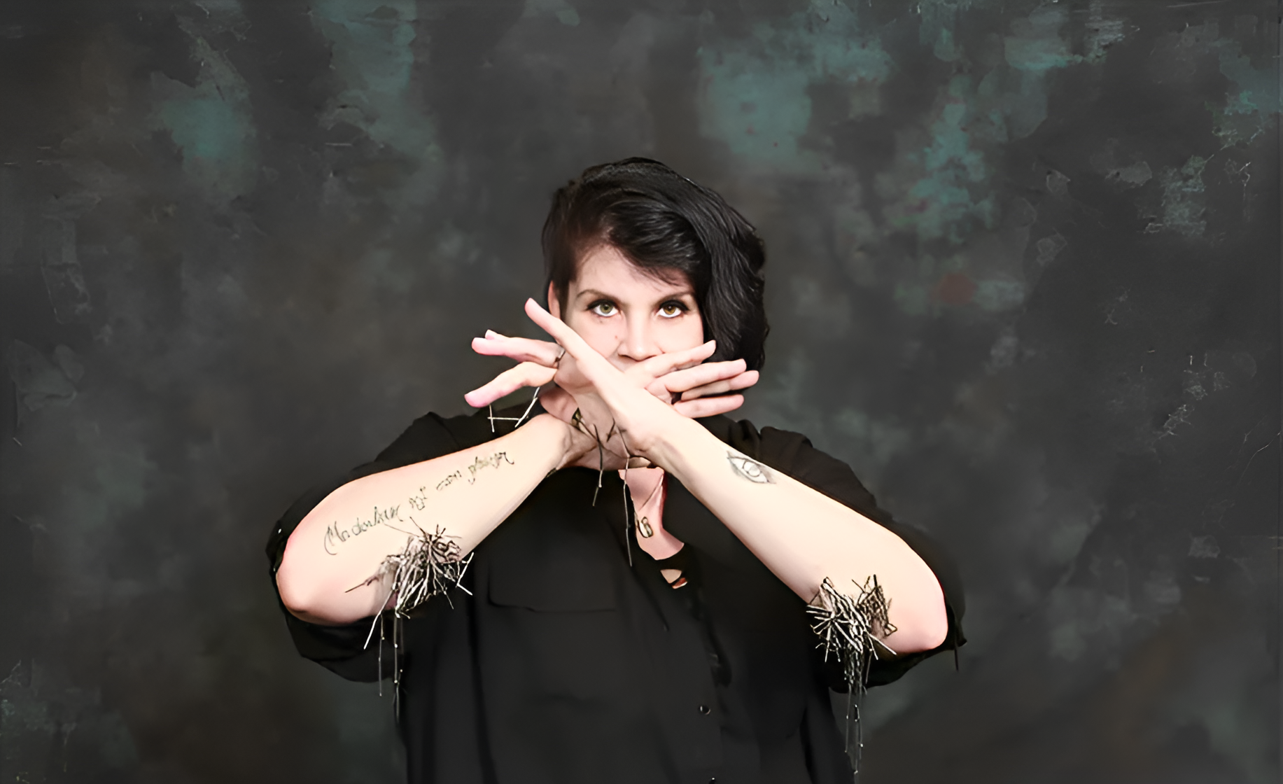 ΗΠΑ: Γυναίκα έχει στο σώμα της 52 τσιπάκια – Είναι στο βιβλίο Γκίνες (βίντεο)