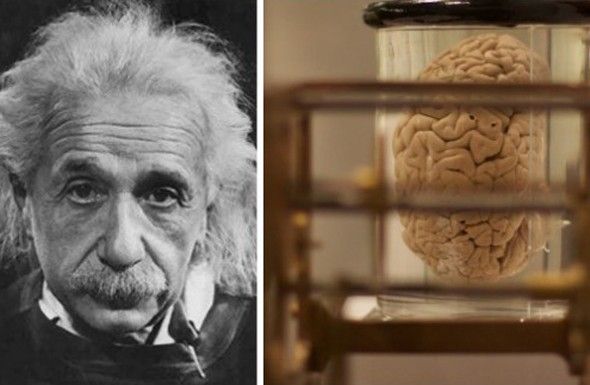 Αυτό το ήξερες; – Που βρίσκονται τα μάτια και ο εγκέφαλος του Αϊνστάιν;
