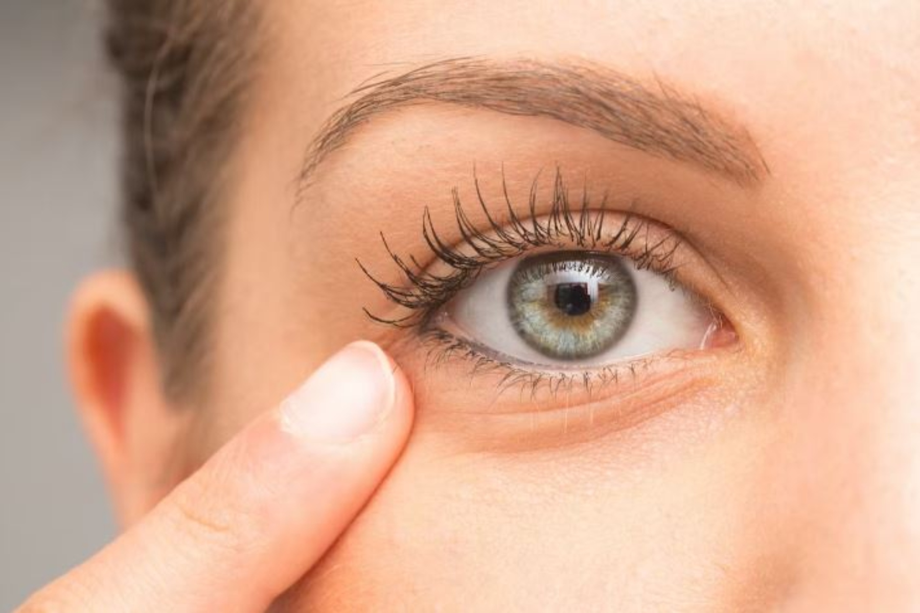 Κριθαράκι στο μάτι: Με αυτούς τους 9 τρόπους θα απαλλαγείτε άμεσα