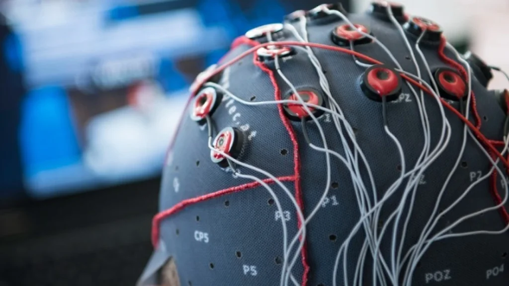 Ελπίδες δίνει νέα τεχνική βαθιάς εγκεφαλικής διέγερσης που αποκαθιστά λειτουργίες σε ασθενείς με εγκεφαλική βλάβη