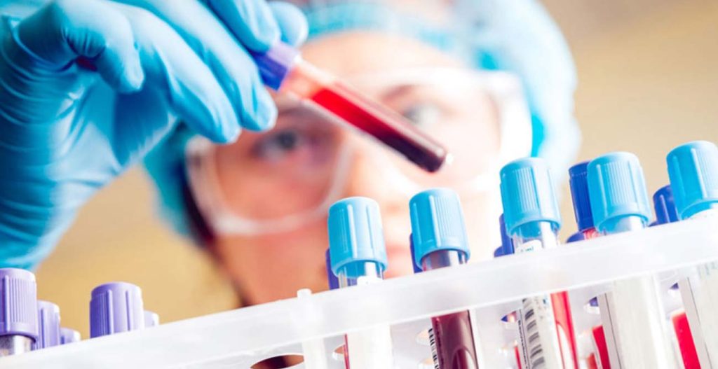 Εξέταση αίματος μπορεί να μας δείξει πόσο γρήγορα γερνούν τα εσωτερικά όργανά μας