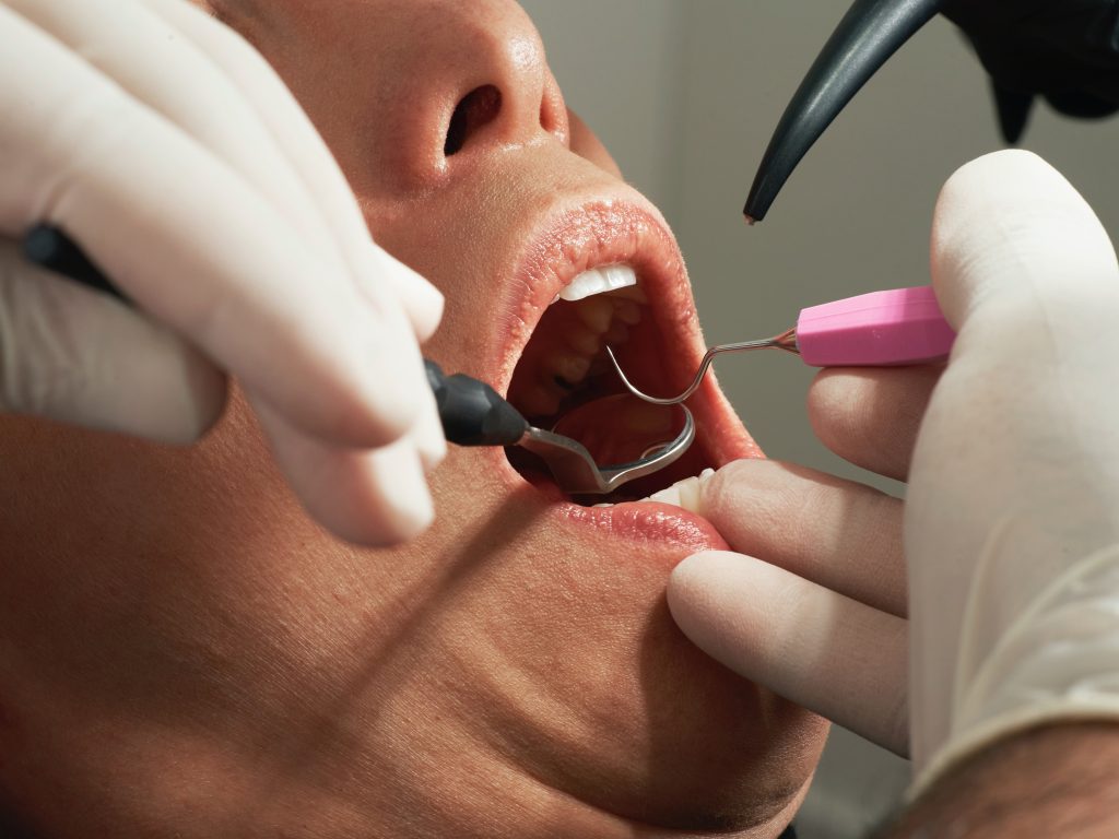 Γαλλία: Πάνω από 1.000 πελάτες οδοντιατρείου «τρέχουν» για τεστ ηπατίτιδας και AIDS