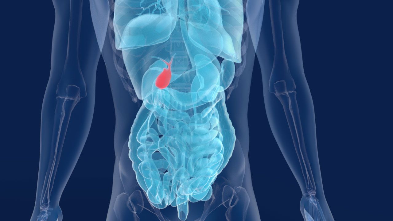 Πέτρες στην χολή: Ποια τα αίτια και οι τρόποι αντιμετώπισης