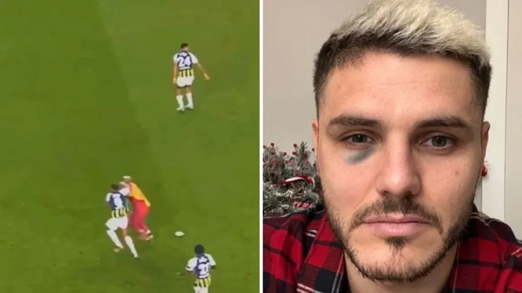 Αντιδράσεις στο Φενέρμπαχτσε – Γαλατάσαραϊ: Διαιτητής δεν έδωσε πέναλτι για μπουνιά στο πρόσωπο του Ικάρντι