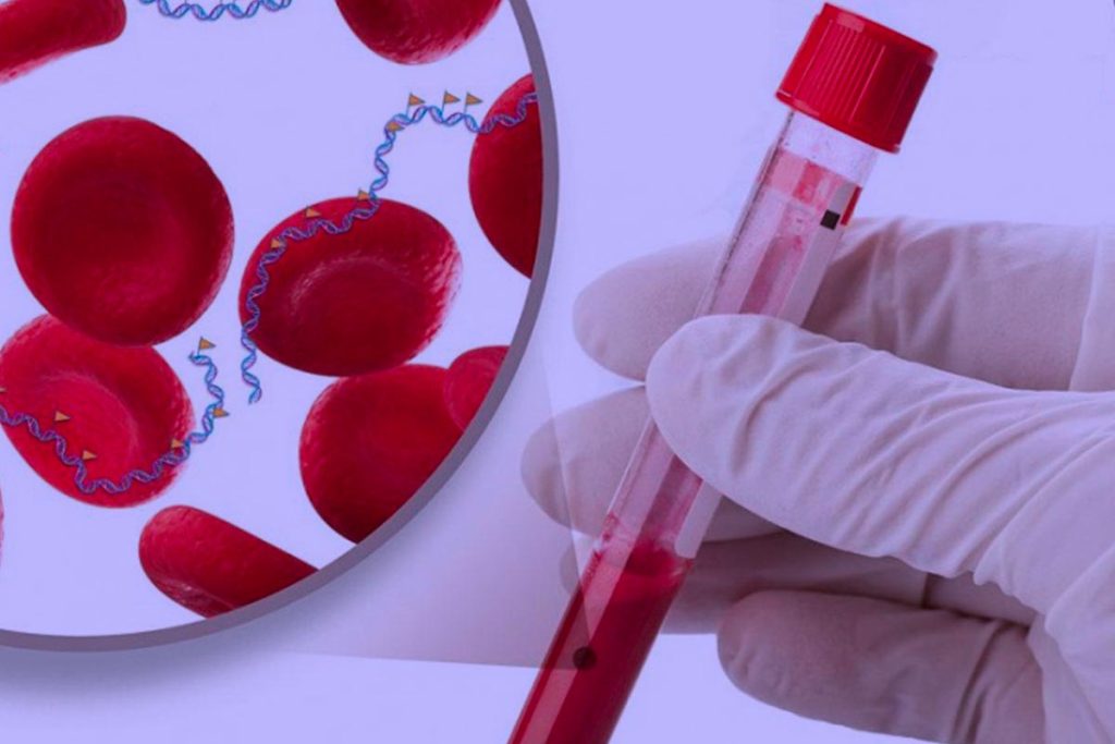 Όλα όσα πρέπει να ξέρετε για τους καρκινικούς δείκτες – Τι αποκαλύπτουν και ποιοι είναι οι πιο κοινοί