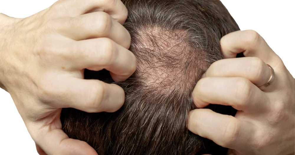Ο θυρεοειδής μπορεί να επηρεάσει την υγεία των μαλλιών; 