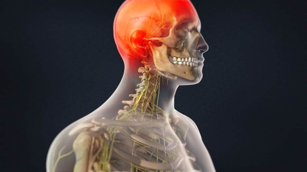 Πονοκέφαλος: Πώς μπορούμε να καταλάβουμε αν οφείλεται σε πρόβλημα στον αυχένα;